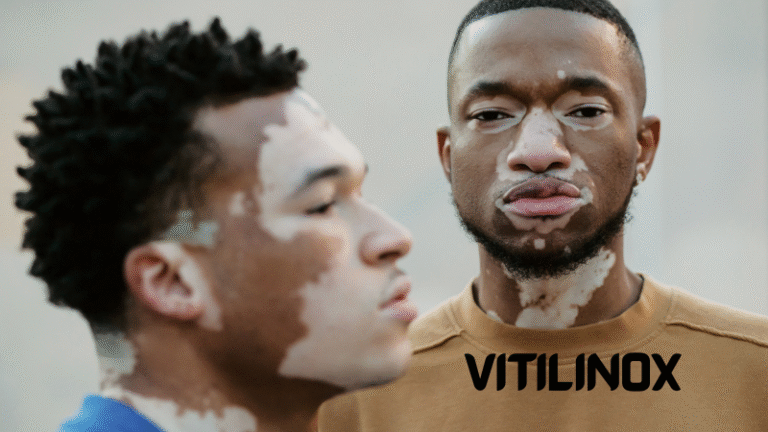 vitilinox
